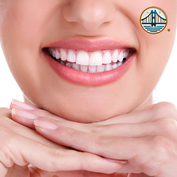 Blanqueamiento dental