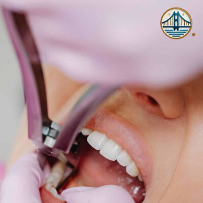 Extracción dental en Albania Extracción dental en Albania
