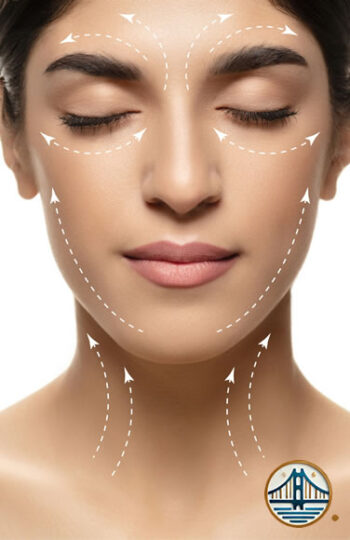 Lifting facial