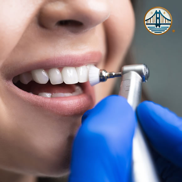 Limpieza dental profesional