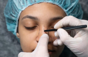 Un conocimiento profundo de la rinoplastia