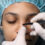 Un conocimiento profundo de la rinoplastia